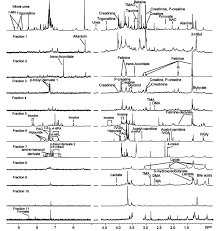 L'acidification par prise de vitamine c a été proposée 2. Https Oatao Univ Toulouse Fr 25386 1 Autuoro 25386 Pdf