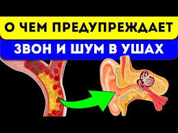 как избавиться от звона в ушах в домашних условиях 3 Kapli Za Uzhinom I Proshel Zvon V Ushah I Golove Youtube V 2020 G Zdorove Ushi Poleznye Sovety