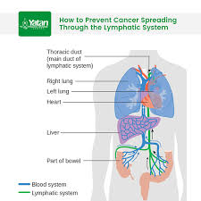 So, it is essential that you embrace a healthier lifestyle; How To Prevent Cancer Spreading Through The Lymphatic System