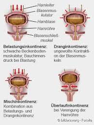 Inkontinenz Beschreibung Formen Ursachen Therapie Netdoktor