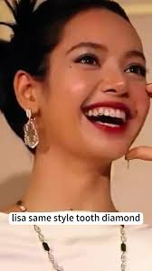 Lisa's DIY Dental Diamond Review