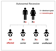 Genetics Of Ocular Albinism The Will To See