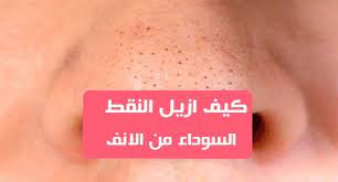 كيف ازيل النقط السوداء من الانفيمكن أن تصبح الرؤوس السوداء كابوسا لأي شخص يريد بشرة جميلة ومثالية وصحية في بعض الأحيان تكون هذه العلامات موجودة جدا على الأنف أ
