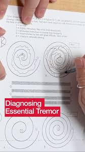 Image result for Essential Tremor