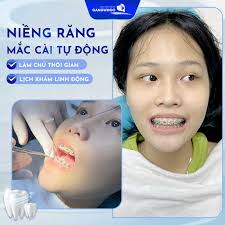 Chỉnh Nha Niềng Răng Công Nghệ Hàn Quốc Chi Phí Tốt -