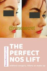 Instant Nose Lift Nose Job Perfect Nose Nose