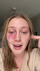 A personal grievance, if you will