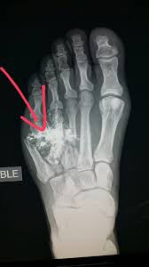 North Broward Radiologists Radiology Radiology Humor Nuclear Medicine