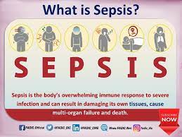 In addition, vasopressors may be required to improve and maintain tissue perfusion. Sepsis Updates In The Management Of Sepsis And Septic Shock Fadic