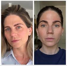 Candace Marino (@thelafacialist) • Instagram photos and videos