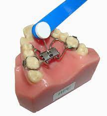 Getting braces is an orthodontic treatment that requires upkeep and maintenance. After Care Baum Braces