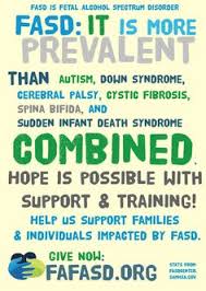 Image result for fetal alcohol disorder quotes