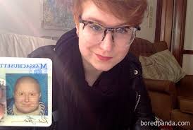 Mangsa yang cedera keluar dengan sendiri sebelum bomba tiba di lokasi, katanya ketika dihubungi di sini hari ini. Berpantang Maut Sebelum Ajal Ini Foto Foto Menakjubkan Sebelum Selepas Kanser Nona