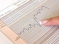 Basal Body Temperature Bbt Charting Www Early Pregnancy Tests Com