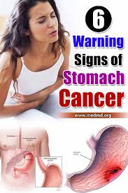 Colorectal cancer might not cause symptoms right away. What Are The Warning Signs Of Gastric Cancer