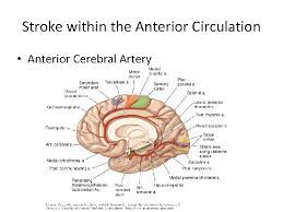 Bilateral anterior cerebral artery (aca) territory infarction is rare and its associated symptoms are still not well understood. Yndromes Part Ii Stroke Syndromes Stroke Within The