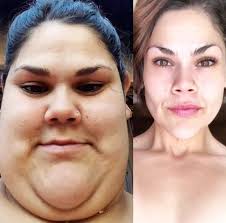 Successful weight loss with keto diet plan