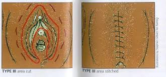 Very small surface mountable package, easy to mount on pcb. A Future Without Female Genital Mutilation World Pulse