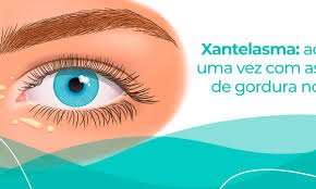 Image result for xantelasma