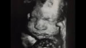Maybe you would like to learn more about one of these? 30 Weeks 3d 4d Ultrasound Our First Video Youtube