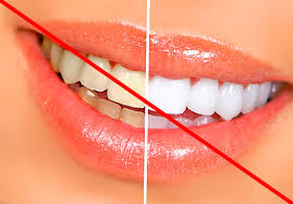 Maybe you would like to learn more about one of these? Crest Toothpaste Cross Dan Ulasan Mengenai Sifatnya