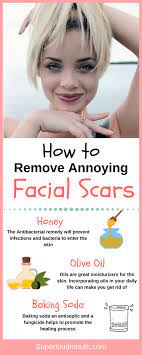 Aug 21, 2020 · be gentle, though, and try not to knock off the scab that is trying to form. 40 Best Ways To Get Rid Of Acne Scabs Overnight Diy Home Remedies Acne Scabs How To Get Rid Of Acne Acne Scab