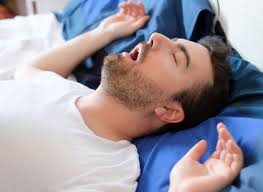 Image result for Obstructive Sleep Apnea