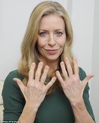 Your hands quickly betray your age but are risky to tamper with  cosmetically