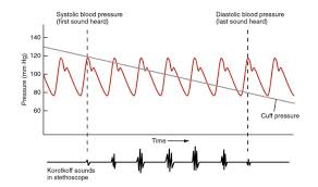 What can i eat to lower my blood pressure immediately? Blood Flow Blood Pressure And Resistance Anatomy And Physiology Ii