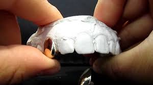 Tsanly gold grillz mouth teeth 24k plated gold custom fit top & bottom set caps grillz for women gift + extra molding bars + microfiber cloth. Single Caps Grillz Youtube