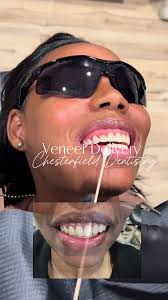 Gum Contouring Tulsa Oklahoma