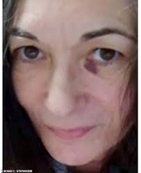 Ghislaine Maxwell seen with a black eye and graying hair in first photo