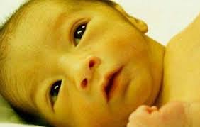 Pendarahan berat atau tidak dapat dijelaskan. Apakah Berbahaya Penyakit Kuning Pada Bayi Balqis Aqiqah