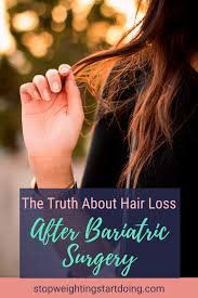 Hair Loss After Bariatric Surgery Is A Common Side Effect It Happens Because The Body Is Under A Lot Of Stress And Not Get In 2020 Bariatric Surgery Bariatric Surgery