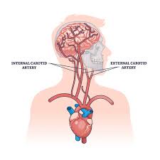Image result for carotid artery