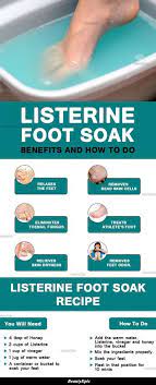 Listerine Foot Soak Benefits And How To Do It The Right Way Listerine Foot Soak Foot Soak Recipe Listerine Feet
