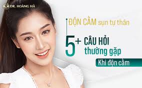 Độn cằm sụn tự thân: 5+ câu hỏi thường gặp khi độn cằm
