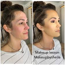 Melasma is difficult but it was a cinch to teach her how to cover it up  with our best selling foundation ￼￼