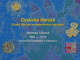 Nemoc tudíž není nakažlivá, pacient se s ní již narodí. Ppt Cysticka Fibroza Cystic Fibrosis Transmembrane Regulator Powerpoint Presentation Id 4717503