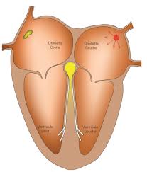 Image result for Extrasystole