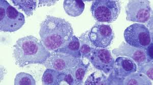 Image result for Rickettsiae