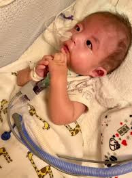 医療 的 ケア 児 ブログ