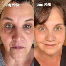 Best Face Mask for Skin Transformation