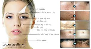 Kim Lăn Tốt Nhất Để Lăn Kim Tại Nhà