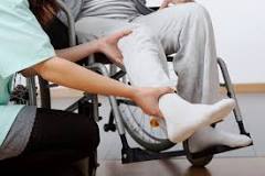 Image result for icd 10 code for end stage parkinson's