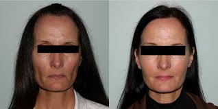 Vein & Cosmetic Center of Tampa Bay