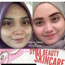 Syma beauty skincare johor bahru. On Twitter Testimoni Pengguna Syma Beauty Jompromote Rtdansebar Rtbusinesson Rtniaga Kltweetniaga Twt Product Rezekikami Kuantantv Https T Co Sjxfw095jt