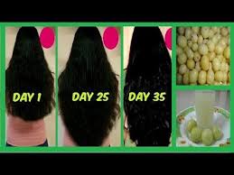 As with its other possible benefits, amla's hair health benefits are still being confirmed. Stop Hair Loss With Garlic Hair Oil Fast Hair Growth In 30 Days For Longer Thicker Natrual Hair Youtube Nidealjezira Fashions Pinterest Fast Hair Gro