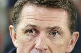 Retired champion jockey AP McCoy to take part in hurling blitz for cancer  charity