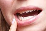 Unsere tipps gegen trockene lippen und was die richtige. Entzundung Der Lippe Ursachen Und Therapie